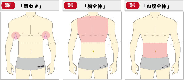 京都メンズ脱毛 キャンペーン第2弾お腹脱毛、胸毛脱毛、脇毛脱毛全3部位