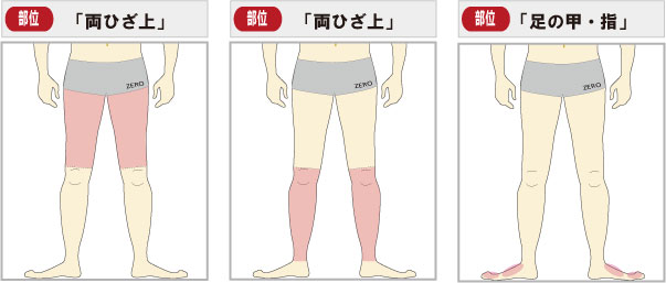 足脱毛全体　可能範囲一覧　(太もも脱毛・すね毛脱毛・足の甲指脱毛)