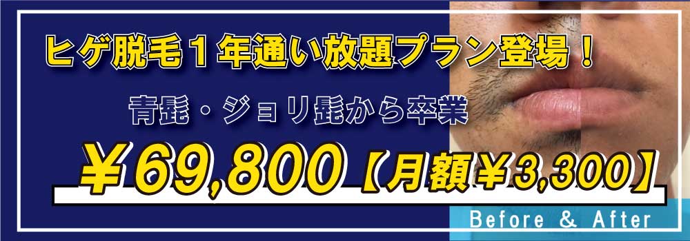 ZERO大阪心斎橋の人気のヒゲ脱毛から通い放題プランが登場！最高24回通えて69,800円。月額3,300円