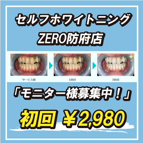 美歯口】セルフホワイトニングで綺麗な歯に!|ホワイトニングZERO山口 美歯口】セルフホワイトニングで綺麗な歯に!|ホワイトニングZERO山口