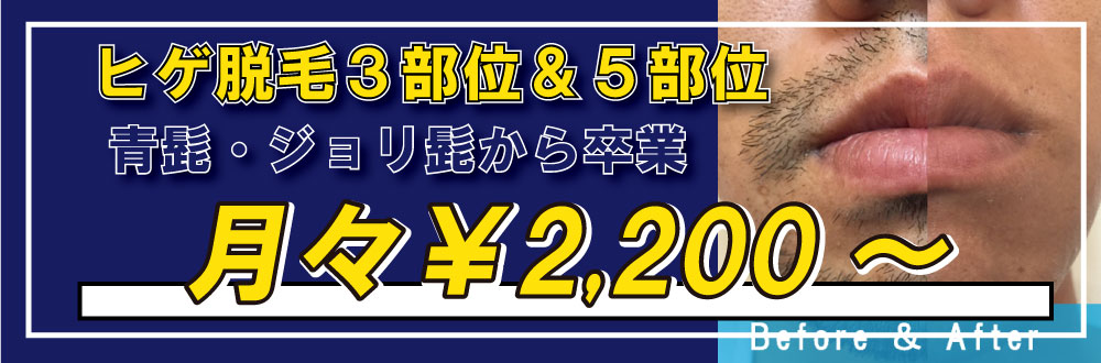 ZERO諫早店のヒゲ脱毛は月額2,200円と長崎で最安値